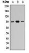 Zinc Finger Protein 441 antibody, GTX56080, GeneTex, Western Blot image 
