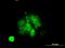 Myocyte Enhancer Factor 2A antibody, H00004205-M08, Novus Biologicals, Immunocytochemistry image 