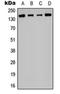 Histone Deacetylase 6 antibody, orb256588, Biorbyt, Western Blot image 