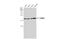 Translocase Of Outer Mitochondrial Membrane 22 antibody, GTX134799, GeneTex, Western Blot image 