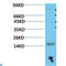 Transthyretin antibody, LS-C813250, Lifespan Biosciences, Western Blot image 