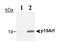 Cyclin-dependent kinase inhibitor 2A, isoform 3 antibody, NB200-169, Novus Biologicals, Western Blot image 
