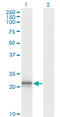Von Hippel-Lindau Tumor Suppressor antibody, LS-C198428, Lifespan Biosciences, Western Blot image 