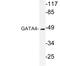 GATA Binding Protein 4 antibody, LS-C176517, Lifespan Biosciences, Western Blot image 