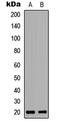 Caspase Recruitment Domain Family Member 19 antibody, GTX56220, GeneTex, Western Blot image 