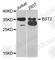 Bone Marrow Stromal Cell Antigen 2 antibody, A1914, ABclonal Technology, Western Blot image 