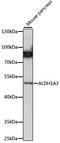 Aldehyde Dehydrogenase 1 Family Member A3 antibody, LS-C750201, Lifespan Biosciences, Western Blot image 