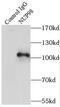 Nucleoporin 98 antibody, FNab05932, FineTest, Immunoprecipitation image 