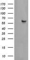 Chaperonin Containing TCP1 Subunit 8 Like 2 antibody, LS-C787543, Lifespan Biosciences, Western Blot image 