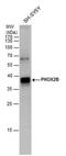 Paired Like Homeobox 2B antibody, PA5-40121, Invitrogen Antibodies, Western Blot image 