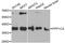 Protein Phosphatase 1 Catalytic Subunit Alpha antibody, A12468, ABclonal Technology, Western Blot image 