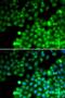 Transgelin 2 antibody, LS-C334925, Lifespan Biosciences, Immunofluorescence image 