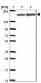 ATP Binding Cassette Subfamily A Member 9 antibody, NBP2-30843, Novus Biologicals, Western Blot image 