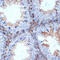 Protein Kinase C Delta antibody, GTX02829, GeneTex, Immunohistochemistry paraffin image 