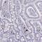 Membrane Spanning 4-Domains A2 antibody, NBP2-31807, Novus Biologicals, Immunohistochemistry paraffin image 