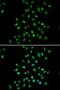 CXXC Finger Protein 1 antibody, LS-B12909, Lifespan Biosciences, Immunofluorescence image 