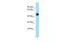 Dual Specificity Phosphatase 7 antibody, PA5-69812, Invitrogen Antibodies, Western Blot image 