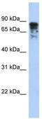 Dihydropyrimidinase Like 3 antibody, TA340020, Origene, Western Blot image 