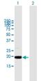 Mitochondrial Ribosomal Protein L49 antibody, H00000740-B01P, Novus Biologicals, Western Blot image 