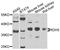 11-cis retinol dehydrogenase antibody, STJ110358, St John