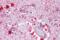 Piwi Like RNA-Mediated Gene Silencing 2 antibody, A04654, Boster Biological Technology, Immunohistochemistry paraffin image 