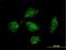 ATP Synthase Inhibitory Factor Subunit 1 antibody, H00093974-B01P, Novus Biologicals, Immunofluorescence image 