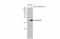p21 antibody, GTX135142, GeneTex, Western Blot image 