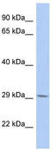 UDP-GlcNAc:BetaGal Beta-1,3-N-Acetylglucosaminyltransferase 6 antibody, TA329578, Origene, Western Blot image 