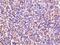 Interleukin 27 Receptor Subunit Alpha antibody, PA5-19985, Invitrogen Antibodies, Immunohistochemistry paraffin image 