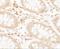 CREB Regulated Transcription Coactivator 2 antibody, GTX31879, GeneTex, Immunohistochemistry paraffin image 