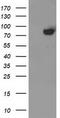 Acyl-CoA Synthetase Short Chain Family Member 2 antibody, TA503610, Origene, Western Blot image 