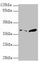 26S proteasome non-ATPase regulatory subunit 7 antibody, A60458-100, Epigentek, Western Blot image 