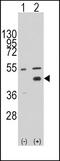 WNT Inhibitory Factor 1 antibody, PA5-12299, Invitrogen Antibodies, Western Blot image 