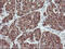 Enoyl-CoA Delta Isomerase 2 antibody, M08254, Boster Biological Technology, Immunohistochemistry paraffin image 