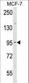 Junction Plakoglobin antibody, LS-C165378, Lifespan Biosciences, Western Blot image 