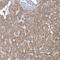 Inositol Polyphosphate-1-Phosphatase antibody, NBP1-85889, Novus Biologicals, Immunohistochemistry frozen image 