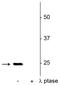 Synaptosome Associated Protein 25 antibody, P01625, Boster Biological Technology, Western Blot image 