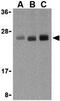TNF Superfamily Member 15 antibody, GTX41272, GeneTex, Western Blot image 