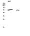 ETS Proto-Oncogene 1, Transcription Factor antibody, A00931, Boster Biological Technology, Western Blot image 