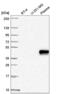 Zinc Finger Protein 672 antibody, NBP2-56351, Novus Biologicals, Western Blot image 