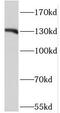 Bifunctional protein NCOAT antibody, FNab05163, FineTest, Western Blot image 