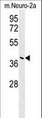 Cancer Susceptibility 4 antibody, LS-B10156, Lifespan Biosciences, Western Blot image 