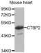 C-Terminal Binding Protein 2 antibody, abx001840, Abbexa, Western Blot image 