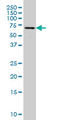 FGR Proto-Oncogene, Src Family Tyrosine Kinase antibody, LS-B12872, Lifespan Biosciences, Western Blot image 