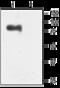Small conductance calcium-activated potassium channel protein 3 antibody, GTX54779, GeneTex, Western Blot image 