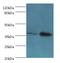 Cathepsin K antibody, MBS1492124, MyBioSource, Western Blot image 