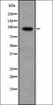 Serine/threonine-protein phosphatase 1 regulatory subunit 10 antibody, orb335070, Biorbyt, Western Blot image 