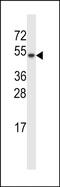 Thioredoxin Domain Containing 15 antibody, PA5-48583, Invitrogen Antibodies, Western Blot image 