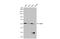 Checkpoint Kinase 1 antibody, GTX70303, GeneTex, Western Blot image 