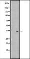 Interleukin 17C antibody, orb337776, Biorbyt, Western Blot image 